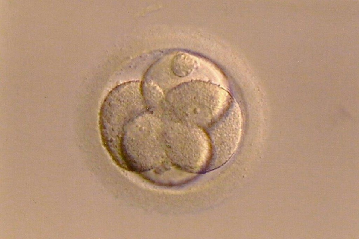 Fertility Treatment Spain